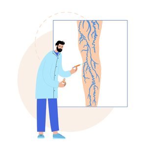 skleroterapi agrili mi