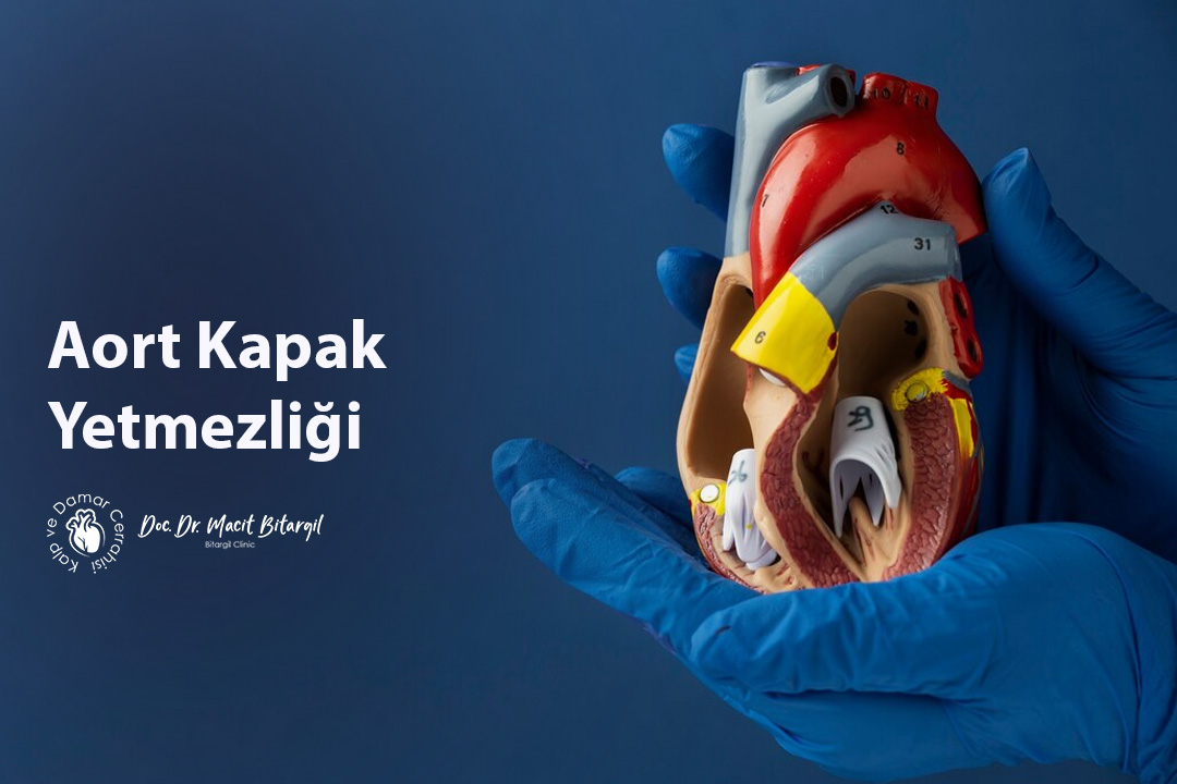 Aort Kapak Yetmezliği