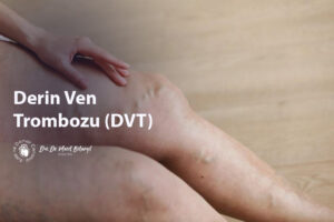 Derin Ven Trombozu (DVT)