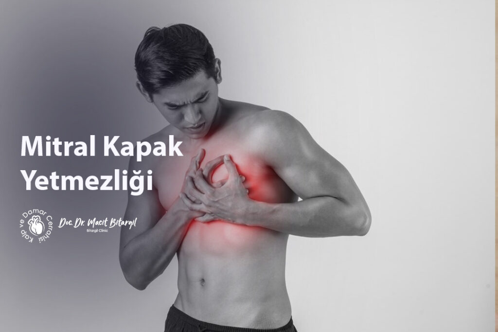 Mitral Kapak Yetmezliği
