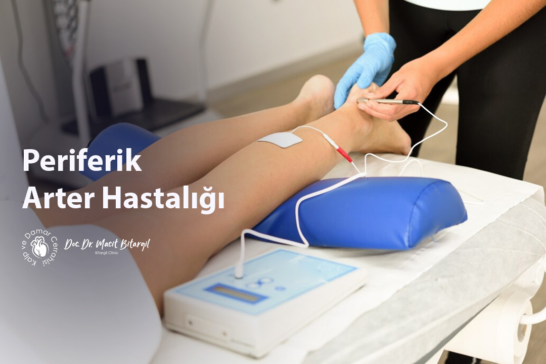 Periferik Arter Hastalığı