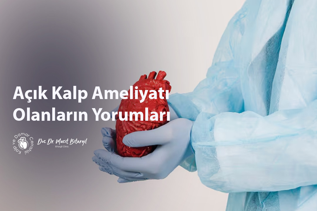 Açık Kalp Ameliyatı Olanların Yorumları