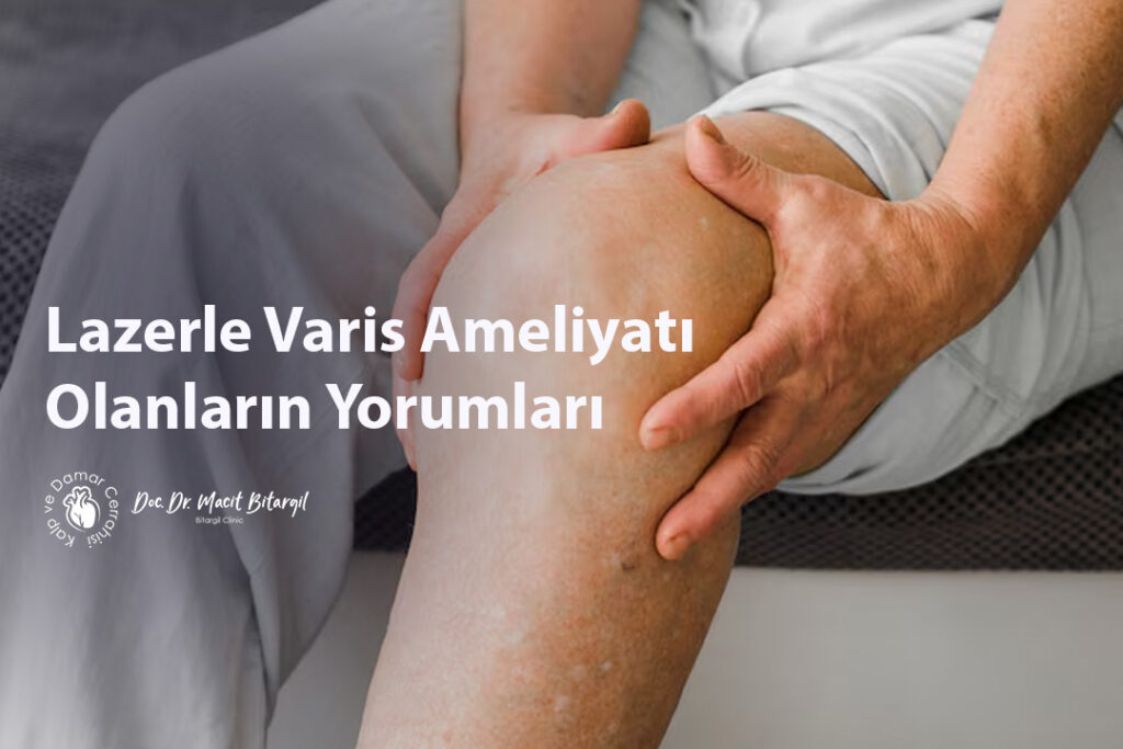 Lazerle Varis Ameliyatı Olanların Yorumları