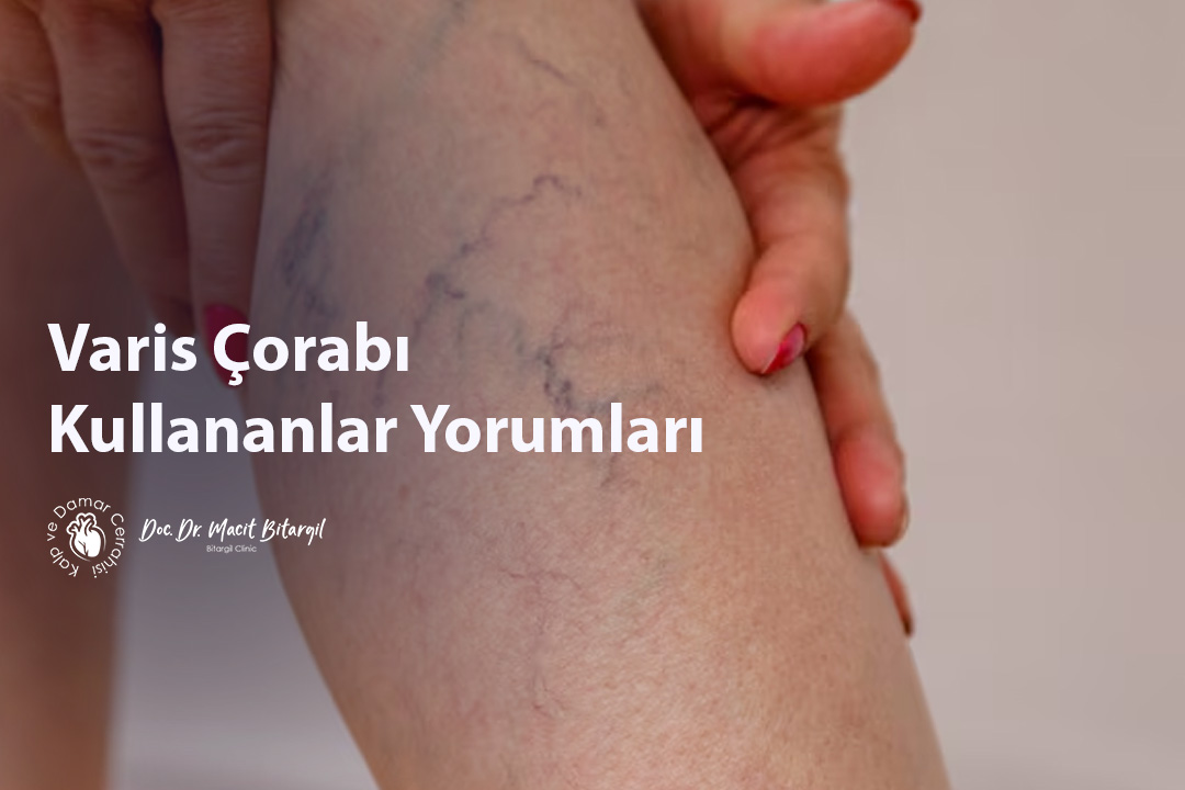 Varis Çorabı Kullananlar Yorumları