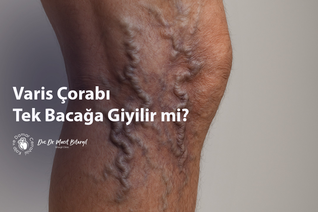 Varis Çorabı Tek Bacağa Giyilir mi