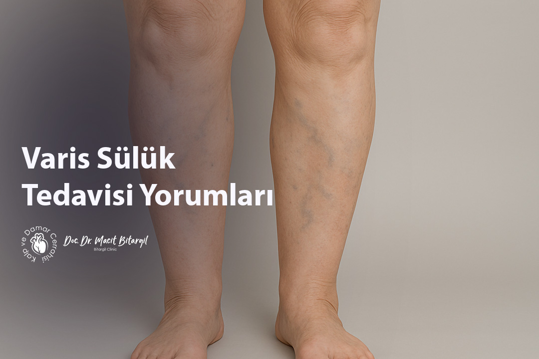 Varis Sülük Tedavisi Yorumları