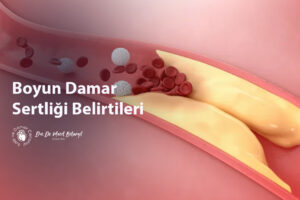 Boyun Damar Sertliği Belirtileri