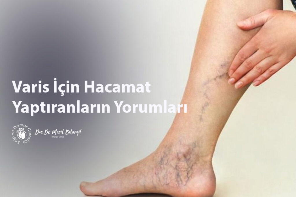 Varis İçin Hacamat Yaptıranların Yorumları