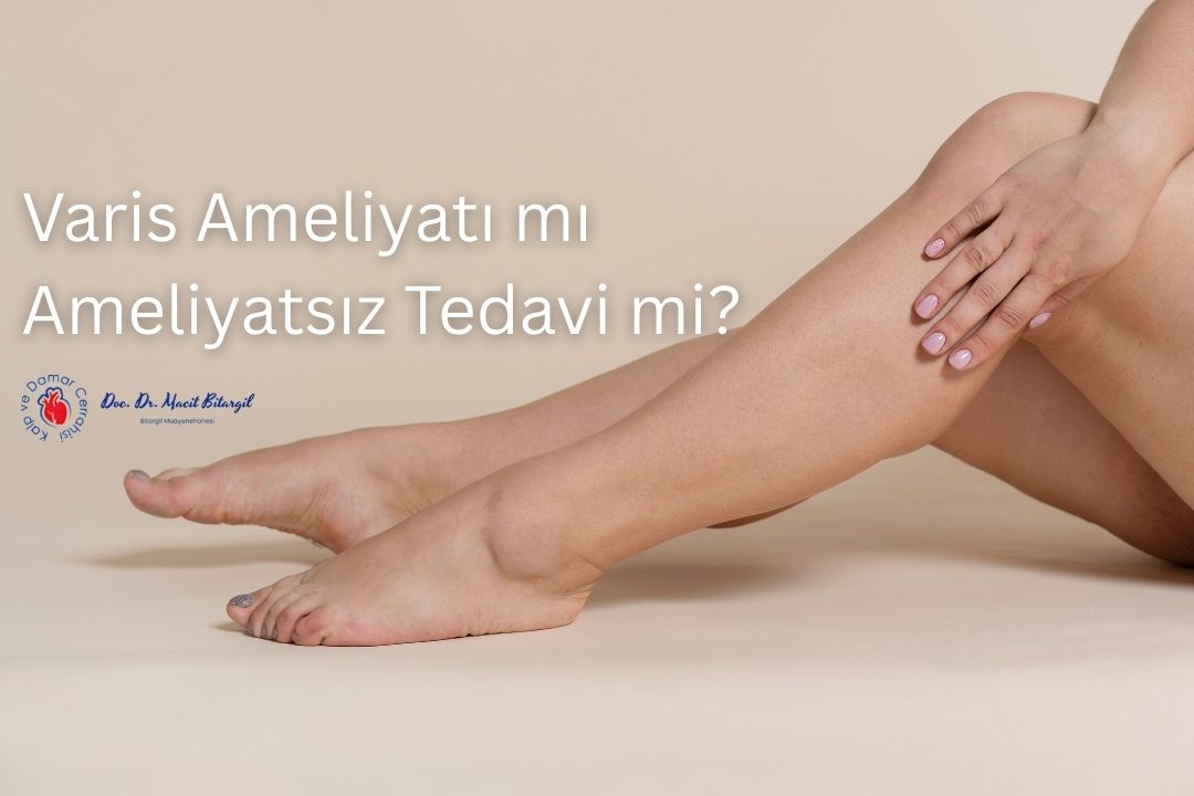 Varis Ameliyatı mı Ameliyatsız Tedavi mi