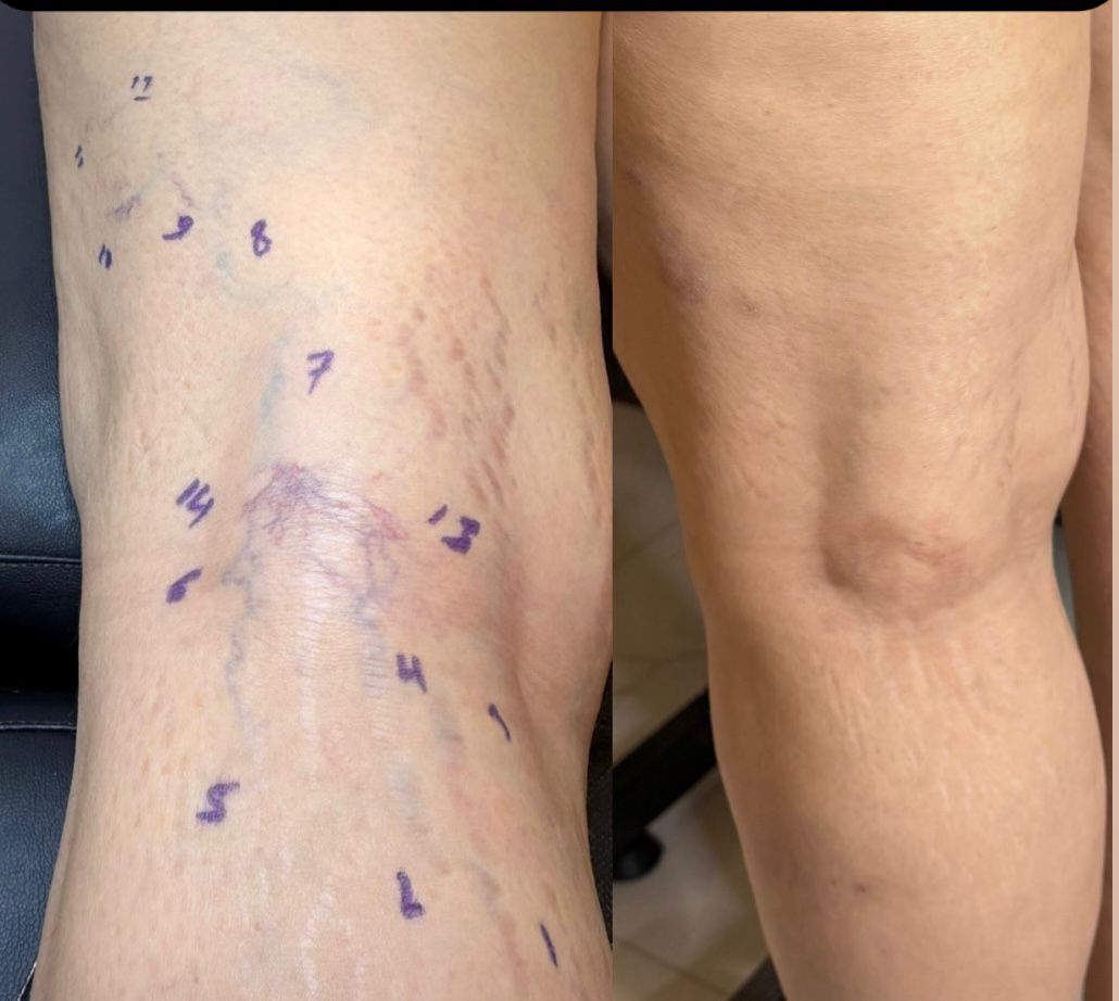 1ac60f00 5db9 4a92 9032 516cfe34909a