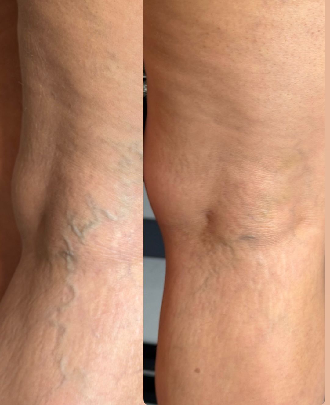 64f0967c 2ae4 4940 9bd0 dd03c1db183e